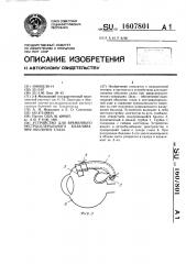 Устройство для временного экстрасклерального вдавливания оболочек глаза (патент 1607801)