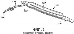 Способ сборки регулируемого бандажа (патент 2372878)