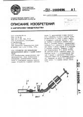 Устройство для имплантации интраокулярной линзы в заднюю камеру глаза (патент 1440496)