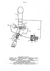 Протез руки (патент 603384)