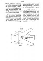 Способ отыскания и восстановления нарушенной мочеполовой диафрагмы (патент 1565485)