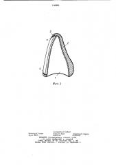 Способ изготовления каркасной коронки (патент 1149962)