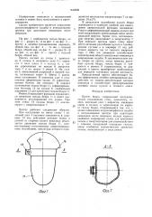 Протез бедра (патент 1442209)