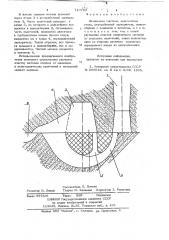 Литниковая система (патент 710753)