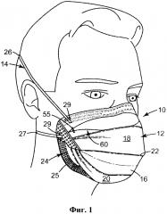 Респиратор в виде фильтрующей лицевой маски, содержащий основу маски с вытачкой (патент 2638629)