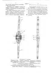 Искусственный коленный сустав системы к.м.сиваша (патент 532377)