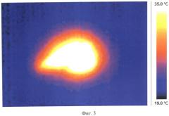 Способ лазерного облучения внутренней поверхности полости биоткани (патент 2492882)