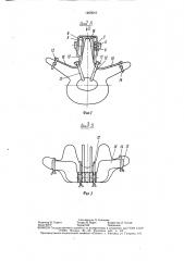 Корректор позвоночника (патент 1465041)