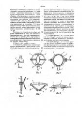 Устройство для массажа (патент 1797890)