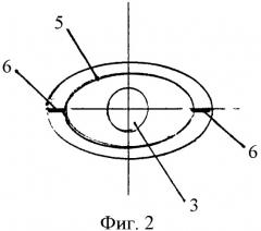 Искусственный хрусталик глаза (патент 2339340)