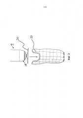 Вкладыш протеза и система гильзы протеза с вкладышем протеза и гильзой протеза (патент 2610202)