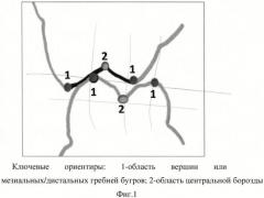 Способ измерения размеров зубов, зубных бугров и их внутренних и наружных скатов (патент 2438617)