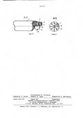 Съемный ортодонтический аппарат (патент 831120)