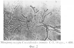 Способ приготовления живых препаратов микроскопических грибов рода coccidioides для световой микроскопии (патент 2496863)