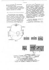 Биоэлектрический способ определения жизнеспособности плода (патент 677746)