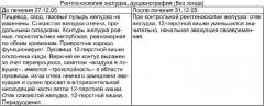 Способ лечения проксимального перидуоденита (патент 2321385)