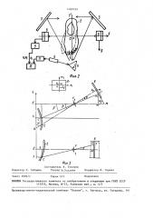 Способ бесконтактного измерения поверхности стопы и голени (патент 1480799)