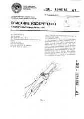 Способ наложения зажима в глубокой ране (патент 1286183)