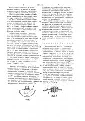 Интравенозный фильтр (патент 1574225)