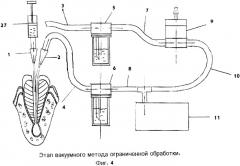 Способ лечения периодонтита аппаратом для эндоканального лечения эндодонтических полостей (патент 2361543)