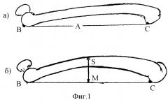 Способ определения длины штифта при внутрикостном остеосинтезе и линейка для этого (патент 2275853)