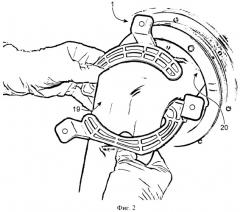 Держатель мягкой перчатки, применяемый в отверстии защитной камеры с перчаткой (патент 2452614)