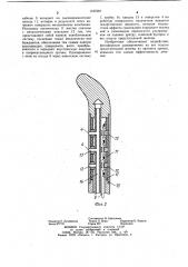 Устройство для лечения полых органов (патент 1127587)