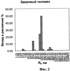 Способ диагностики уролитиаза (патент 2504786)