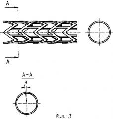 Расправляемый внутрисосудистый стент (патент 2350301)