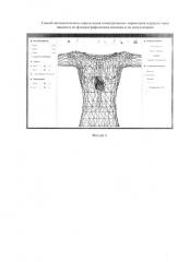 Способ автоматического определения геометрических параметров сердца и торса пациента по флюорографическим снимкам и их визуализации (патент 2639018)