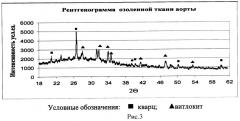 Способ выделения минералов в соединительной ткани человека методом низкотемпературного озоления ткани (патент 2463594)