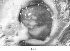 Способ моделирования грибкового кератита у кроликов (патент 2346338)