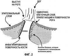 Чрескожный протез (патент 2406466)