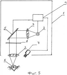 Способ лечения аномалий рефракции воздействием ультрафиолетового излучения и устройство для его реализации (патент 2419402)