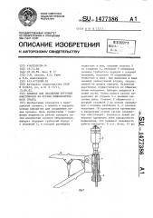 Аппарат для наложения круговых анастомозов на органы пищеварительного тракта (патент 1477386)