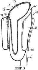 Ортопедическое переходное устройство (патент 2472430)