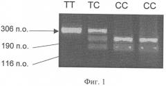Способ прогнозирования прогрессирующего течения хронического гепатита с (развития цирроза печени) путем анализа комбинации полиморфизмов генов цитокинов (патент 2317335)