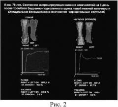 Способ оценки резервов дистального кровообращения конечностей (патент 2530764)