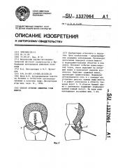 Способ лечения обширных грыж живота (патент 1337064)