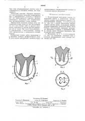 Искусственный желудочек сердца (патент 520009)