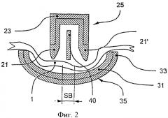 Электрохирургические щипцы (патент 2522903)