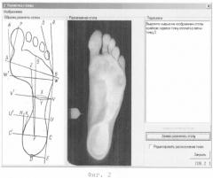 Способ диагностики состояния отделов стопы (патент 2253363)