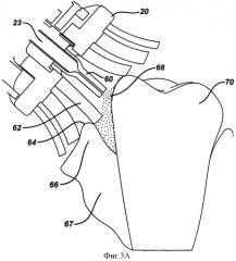 Способ ухода за полостью рта, устройство и система для его осуществления (варианты) (патент 2352289)
