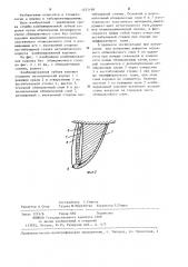 Комбинированная зубная коронка (патент 1237198)