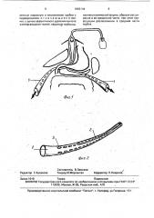 Способ лечения гнойного панкреатита и устройство для его осуществления (патент 1803144)