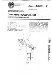 Устройство для артродеза тазобедренного сустава (патент 1250279)
