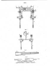 Устройство для фиксации фрагментов нижней челюсти (патент 982681)