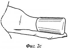 Набор для лечения онихомикоза (патент 2514547)