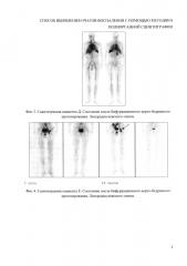 Способ выявления очагов воспаления с помощью методики полиорганной сцинтиграфии (патент 2648877)