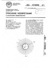 Сепарирующий ротор корнеуборочной машины (патент 1576006)